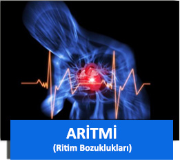 aritmi son